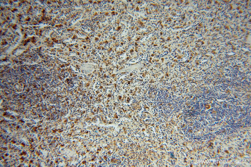 Immunohistochemistry (IHC) staining of human spleen tissue using ATP6V1G1 Polyclonal antibody (16143-1-AP)