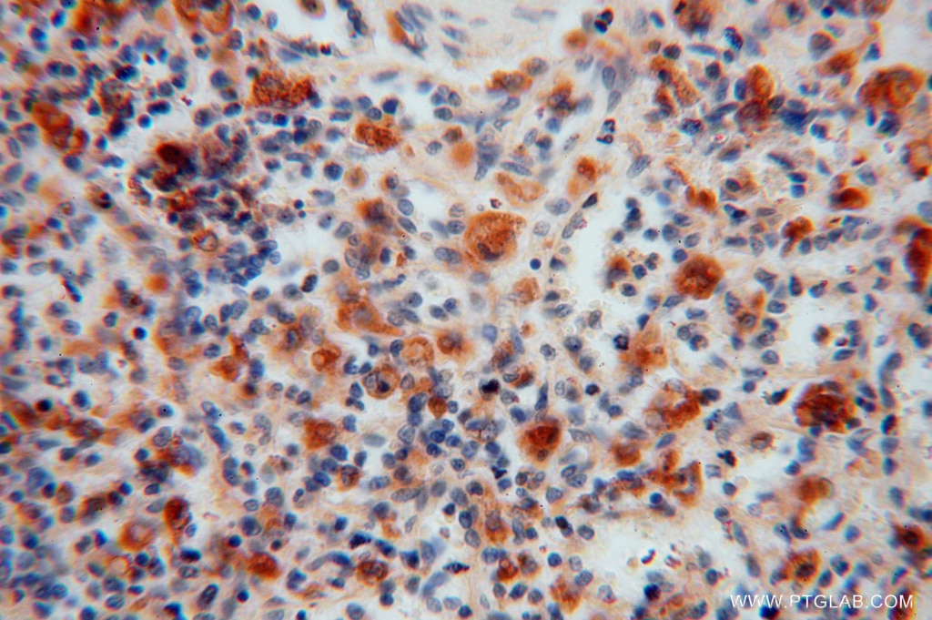 Immunohistochemistry (IHC) staining of human spleen tissue using ATP6V1G1 Polyclonal antibody (16143-1-AP)