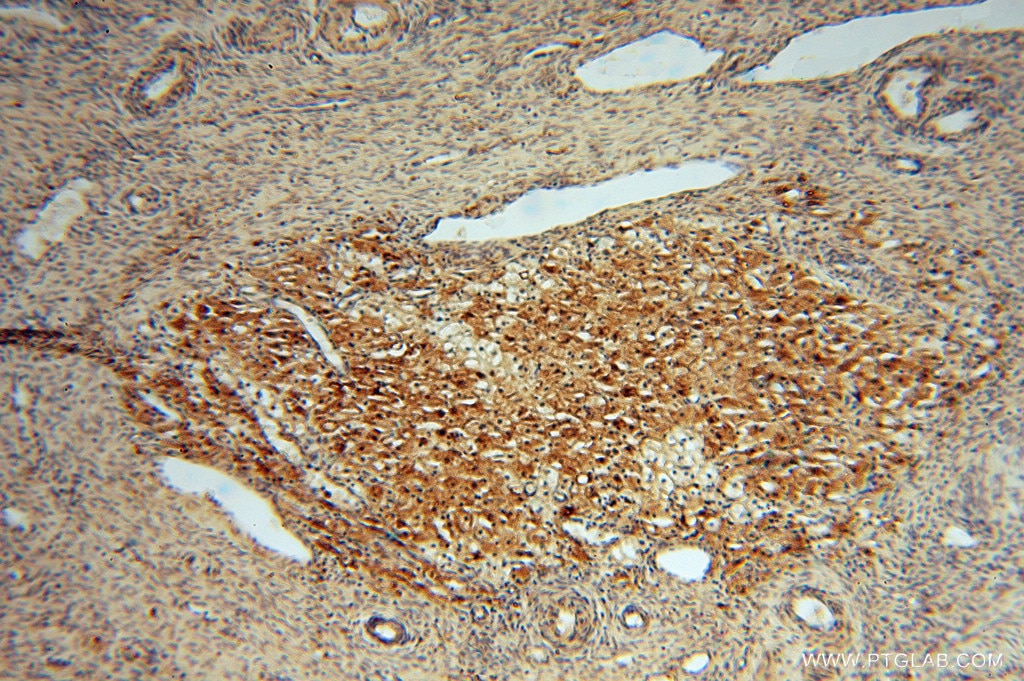 Immunohistochemistry (IHC) staining of human ovary tissue using ATP6V1G1 Polyclonal antibody (16143-1-AP)