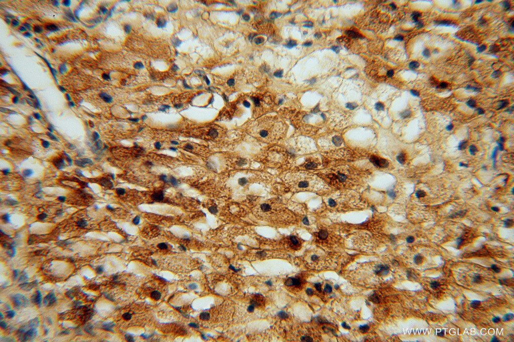 Immunohistochemistry (IHC) staining of human ovary tissue using ATP6V1G1 Polyclonal antibody (16143-1-AP)