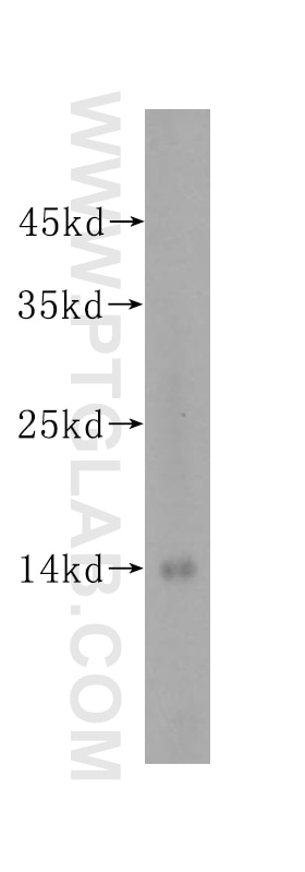 Western Blot (WB) analysis of Jurkat cells using ATP6V1G1 Polyclonal antibody (16143-1-AP)