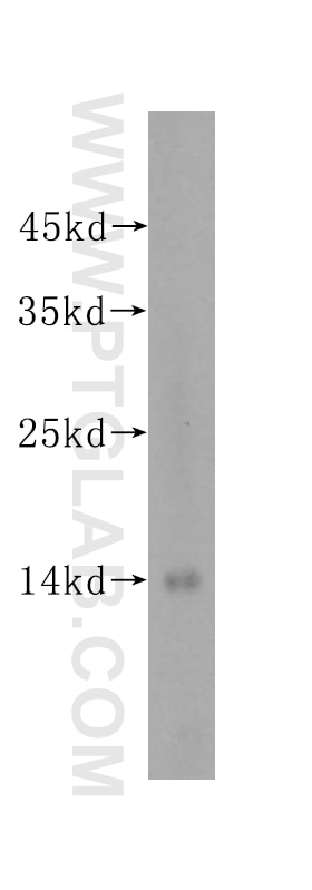 WB analysis of Jurkat using 16143-1-AP