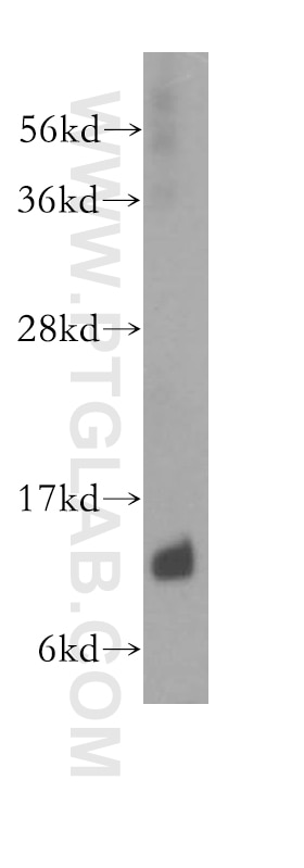 Western Blot (WB) analysis of human kidney tissue using ATP6V1G1 Polyclonal antibody (16143-1-AP)
