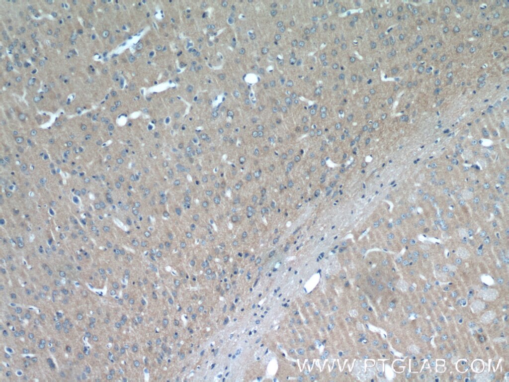 Immunohistochemistry (IHC) staining of mouse brain tissue using ATP6V1G2 Polyclonal antibody (25316-1-AP)