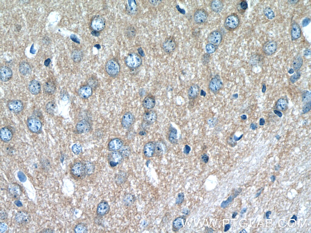 Immunohistochemistry (IHC) staining of mouse brain tissue using ATP6V1G2 Polyclonal antibody (25316-1-AP)