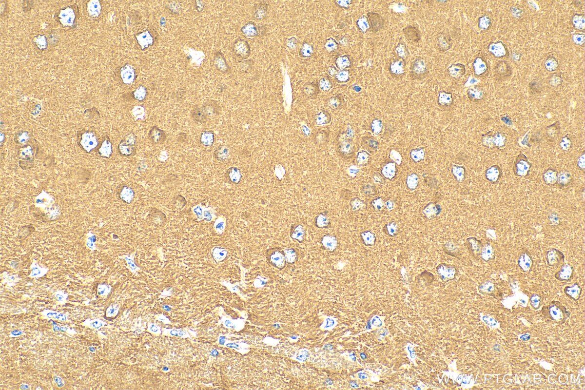 Immunohistochemistry (IHC) staining of mouse brain tissue using ATP6V1G2 Polyclonal antibody (25316-1-AP)