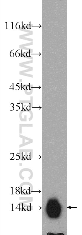 Western Blot (WB) analysis of rat brain tissue using ATP6V1G2 Polyclonal antibody (25316-1-AP)