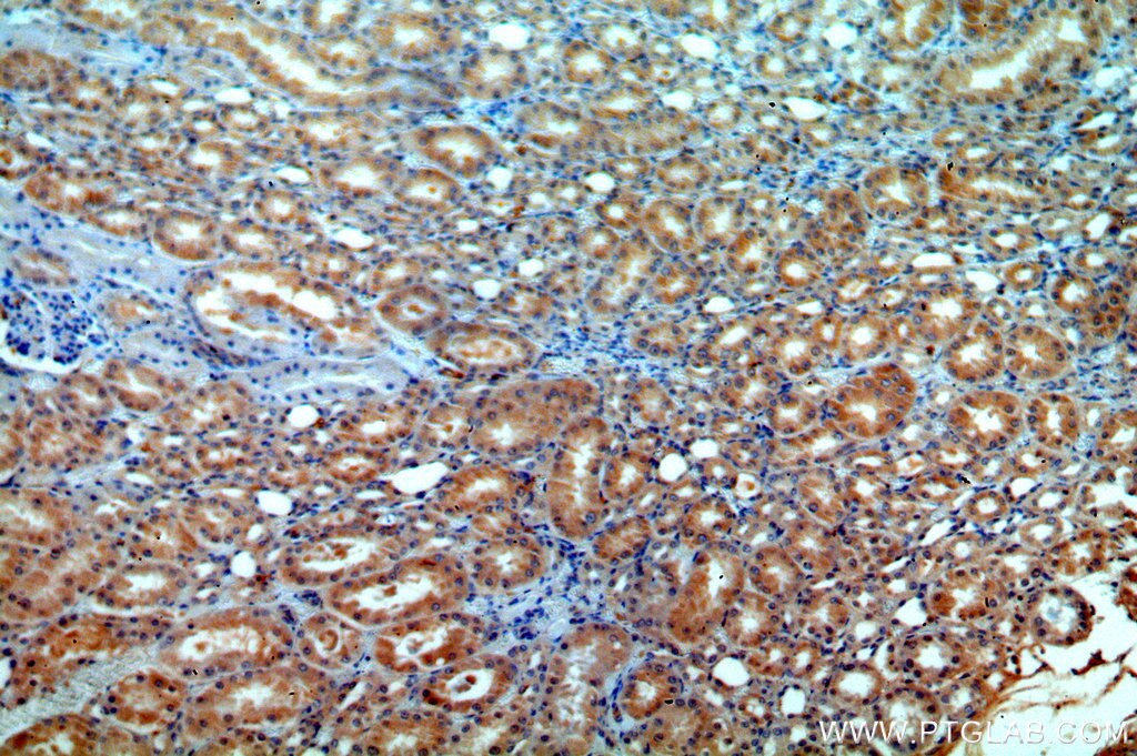 Immunohistochemistry (IHC) staining of human kidney tissue using ATP6V1G3 Polyclonal antibody (19523-1-AP)