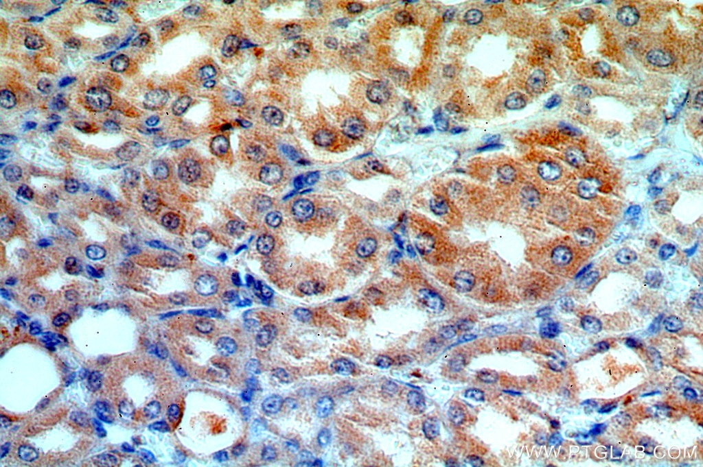 Immunohistochemistry (IHC) staining of human kidney tissue using ATP6V1G3 Polyclonal antibody (19523-1-AP)