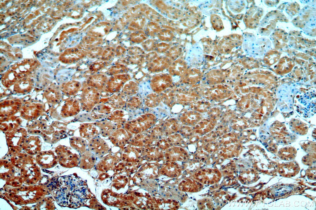 IHC staining of human kidney using 19523-1-AP