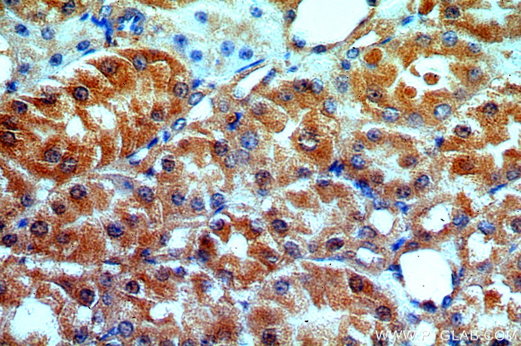 Immunohistochemistry (IHC) staining of human kidney tissue using ATP6V1G3 Polyclonal antibody (19523-1-AP)