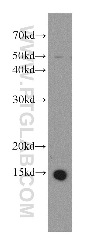 Western Blot (WB) analysis of HEK-293 cells using ATP6V1G3 Polyclonal antibody (19523-1-AP)