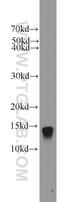Western Blot (WB) analysis of mouse kidney tissue using ATP6V1G3 Polyclonal antibody (19523-1-AP)