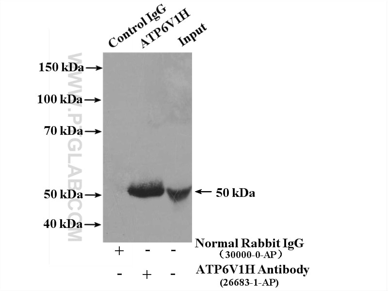 Immunoprecipitation (IP) experiment of mouse brain tissue using ATP6V1H Polyclonal antibody (26683-1-AP)