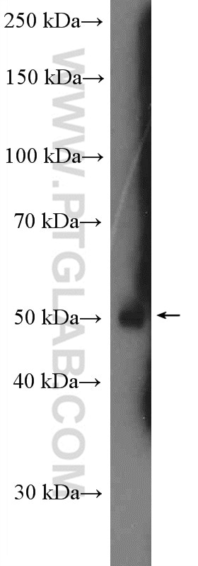 Western Blot (WB) analysis of rat brain tissue using ATP6V1H Polyclonal antibody (26683-1-AP)