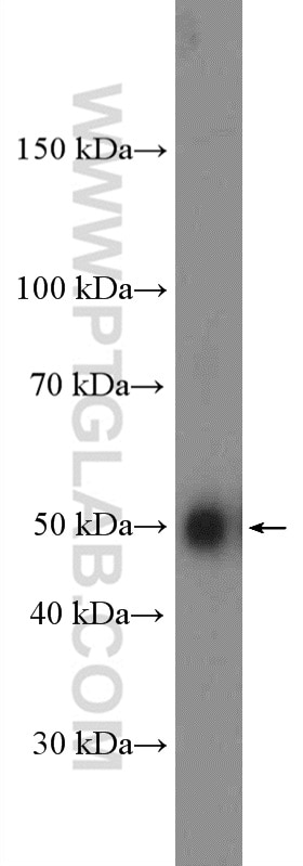 Western Blot (WB) analysis of mouse brain tissue using ATP6V1H Polyclonal antibody (26683-1-AP)