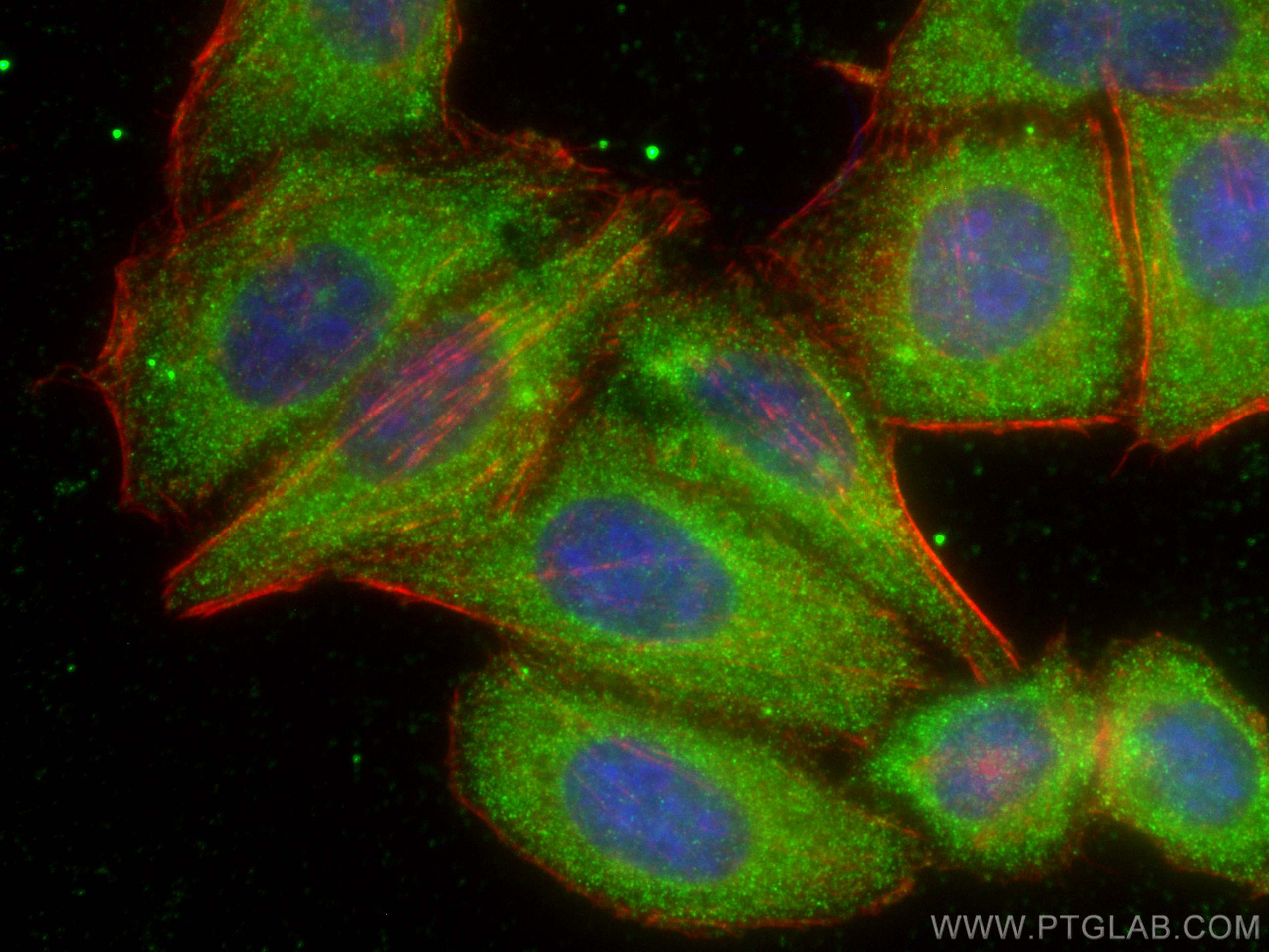 Immunofluorescence (IF) / fluorescent staining of HepG2 cells using ATP6V1H Monoclonal antibody (68425-1-Ig)