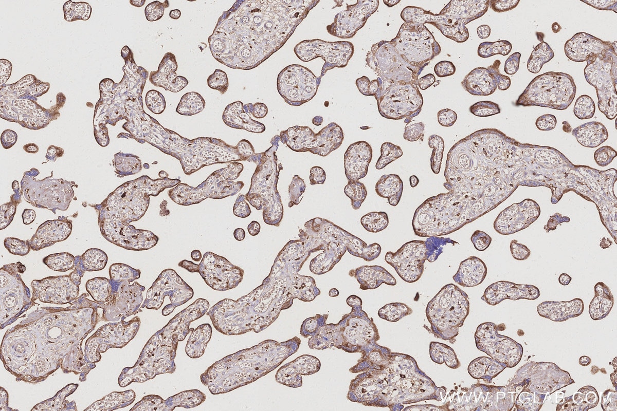 IHC staining of human placenta using 68425-1-Ig Immunohistochemistry (IHC) staining of human placenta tissue using ATP6V1H Monoclonal antibody (68425-1-Ig)