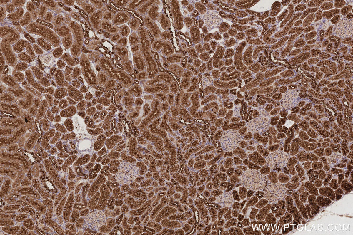 IHC staining of rat kidney using 68425-1-Ig Immunohistochemistry (IHC) staining of rat kidney tissue using ATP6V1H Monoclonal antibody (68425-1-Ig)