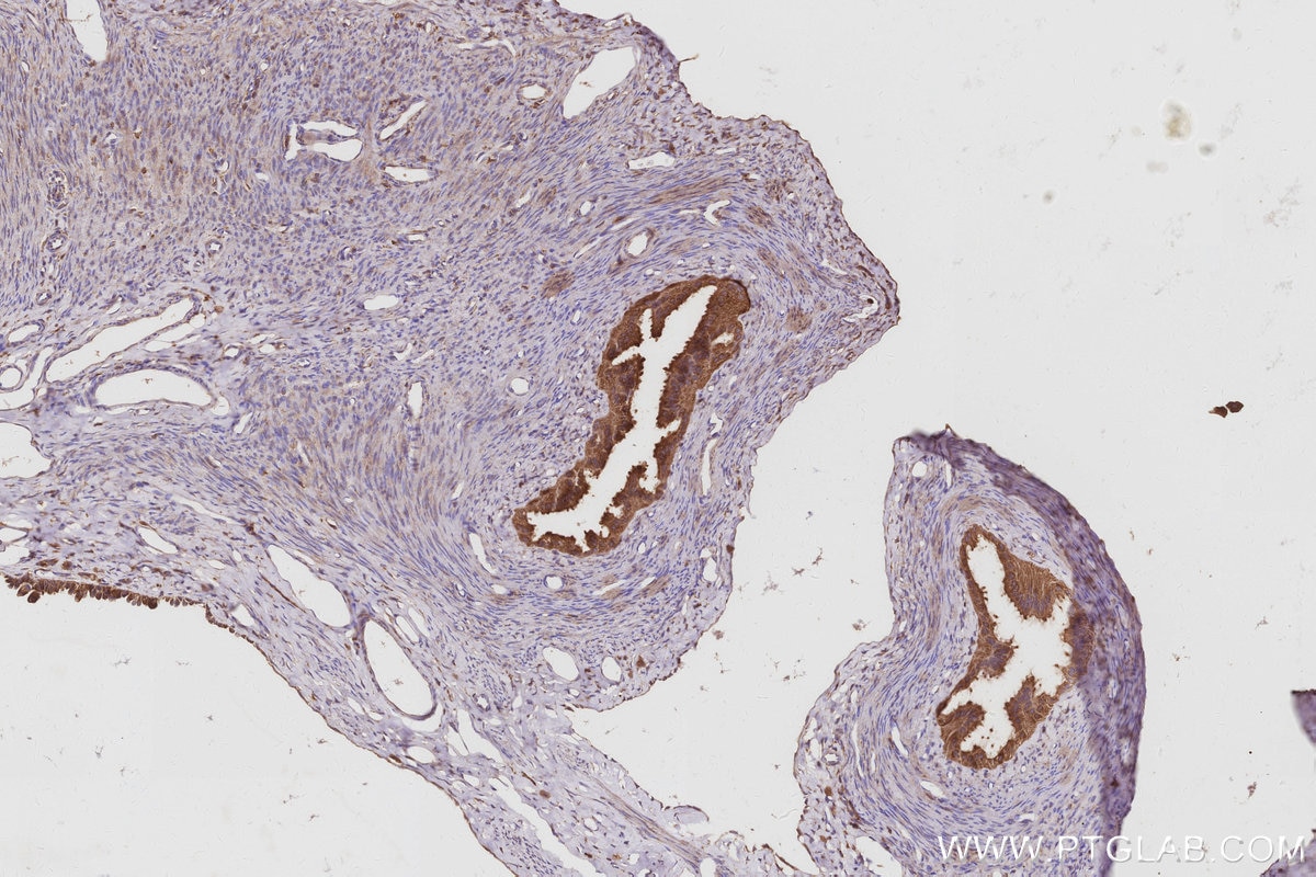 IHC staining of rat ovary using 68425-1-Ig Immunohistochemistry (IHC) staining of rat ovary tissue using ATP6V1H Monoclonal antibody (68425-1-Ig)