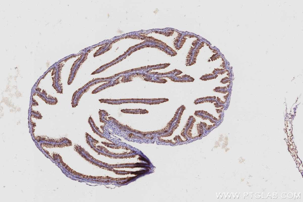 IHC staining of mouse ovary using 68425-1-Ig Immunohistochemistry (IHC) staining of mouse ovary tissue using ATP6V1H Monoclonal antibody (68425-1-Ig)