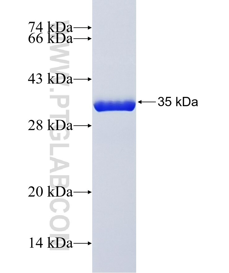 ATP7A fusion protein Ag41320 SDS-PAGE