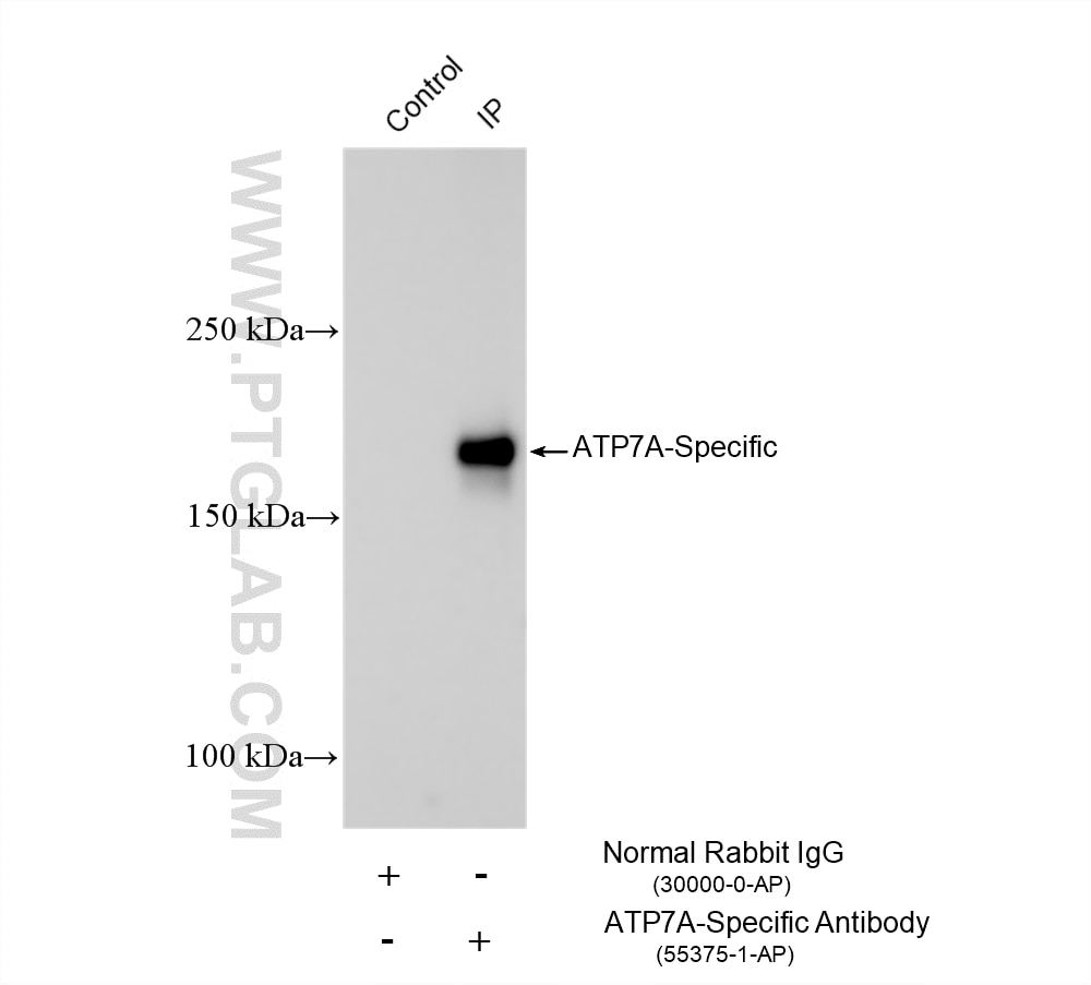 Immunoprecipitation (IP) experiment of mouse lung tissue using ATP7A-Specific Polyclonal antibody (55375-1-AP)