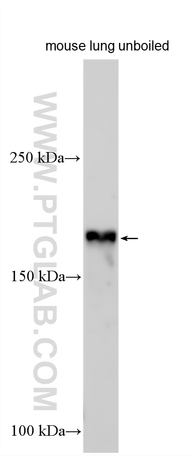 Western Blot (WB) analysis of various lysates using ATP7A-Specific Polyclonal antibody (55375-1-AP)
