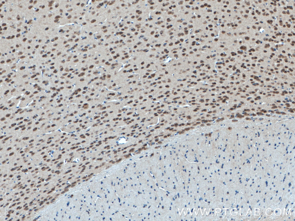 Immunohistochemistry (IHC) staining of mouse brain tissue using ATP7B-Specific Polyclonal antibody (19786-1-AP)