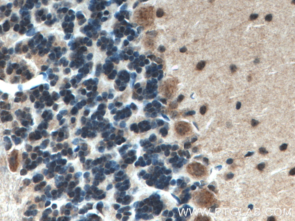 Immunohistochemistry (IHC) staining of mouse brain tissue using ATP7B-Specific Polyclonal antibody (19786-1-AP)