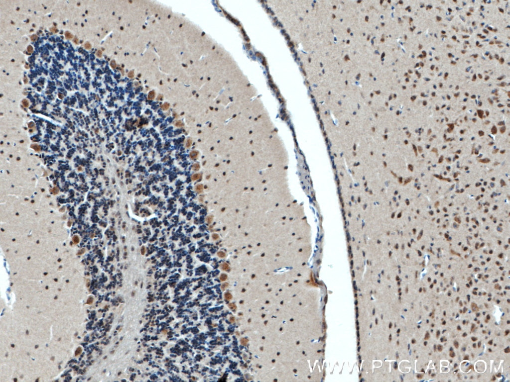 Immunohistochemistry (IHC) staining of mouse brain tissue using ATP7B-Specific Polyclonal antibody (19786-1-AP)