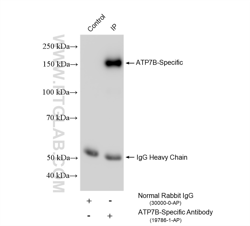 Immunoprecipitation (IP) experiment of Caco-2 cells using ATP7B-Specific Polyclonal antibody (19786-1-AP)