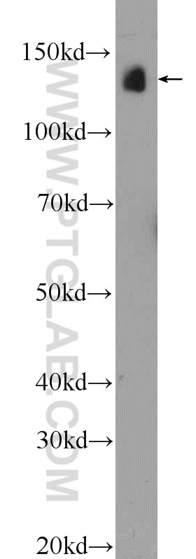 ATP7B-Specific Polyclonal antibody