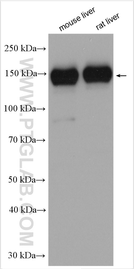 Western Blot (WB) analysis of various lysates using ATP7B-Specific Polyclonal antibody (19786-1-AP)