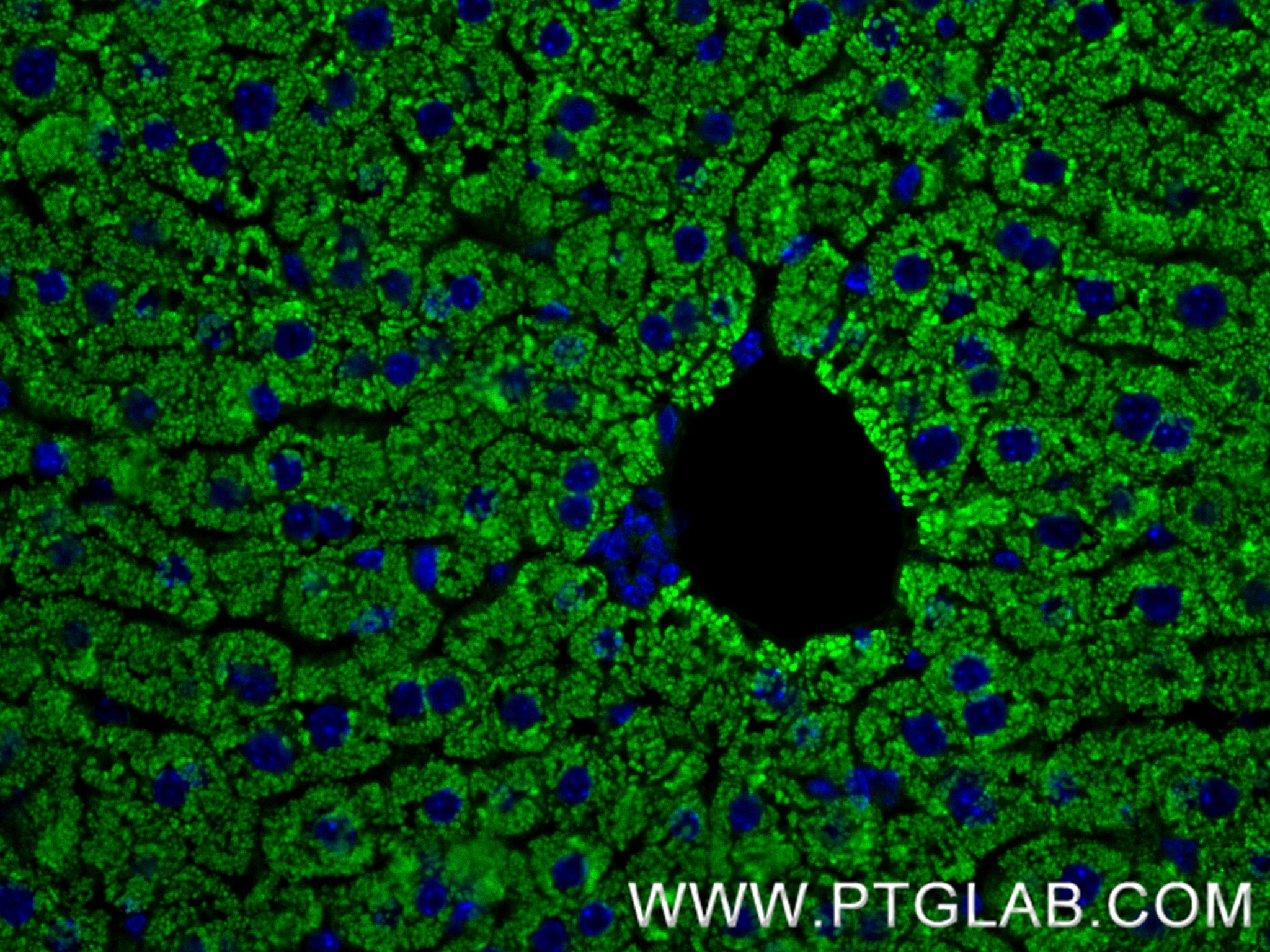 Immunofluorescence (IF) / fluorescent staining of mouse liver tissue using ATP7B-Specific Recombinant antibody (85288-2-RR)