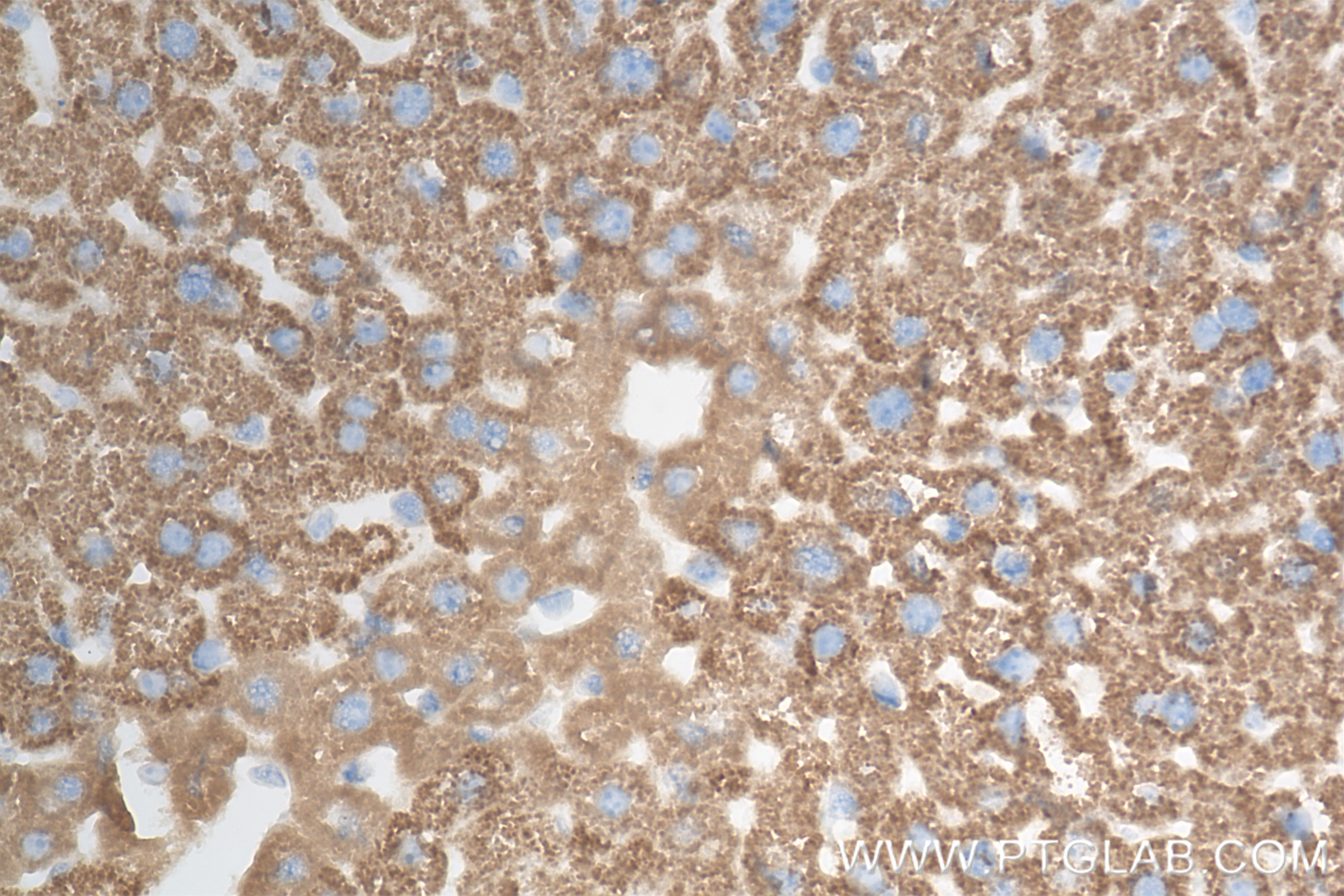 Immunohistochemistry (IHC) staining of mouse liver tissue using ATP7B-Specific Recombinant antibody (85288-2-RR)