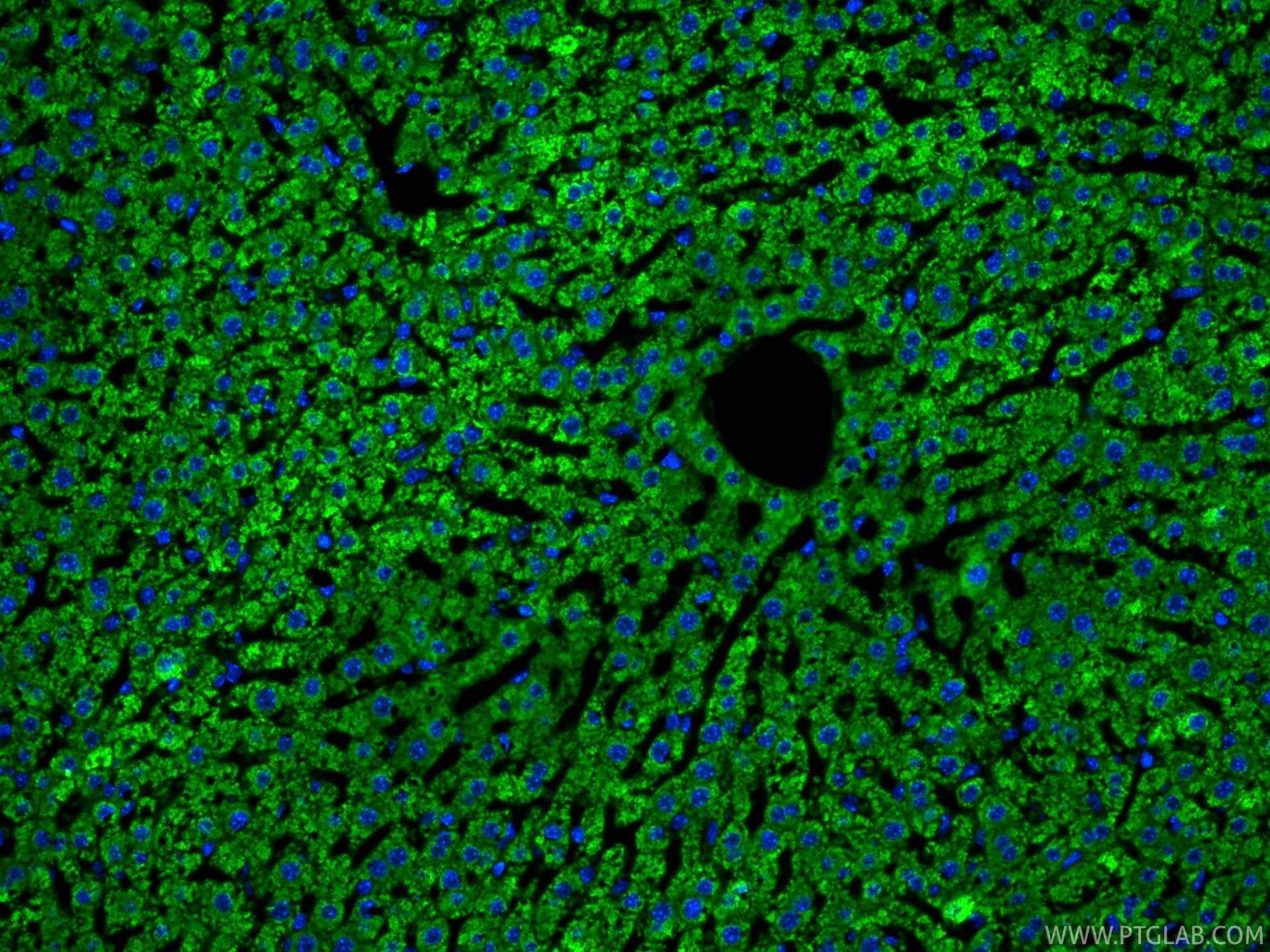 Immunofluorescent analysis of (4% PFA) fixed paraffin-embedded mouse liver tissue using CoraLite® Plus 488 ATP7B-Specific antibody (CL488-85288-2, Clone: 242827B3 ) at dilution of 1:200. Heat mediated antigen retrieval with Tris-EDTA buffer (pH 9.0). Immunofluorescence (IF) / fluorescent staining of mouse liver tissue using CoraLite® Plus 488-conjugated ATP7B-Specific Recom (CL488-85288-2)
