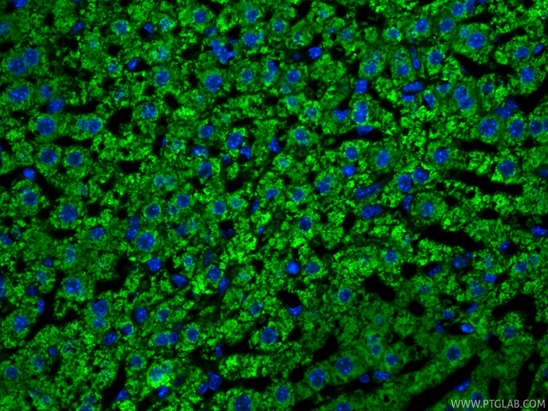 Immunofluorescent analysis of (4% PFA) fixed paraffin-embedded mouse liver tissue using CoraLite® Plus 488 ATP7B-Specific antibody (CL488-85288-2, Clone: 242827B3 ) at dilution of 1:200. Heat mediated antigen retrieval with Tris-EDTA buffer (pH 9.0). Immunofluorescence (IF) / fluorescent staining of mouse liver tissue using CoraLite® Plus 488-conjugated ATP7B-Specific Recom (CL488-85288-2)