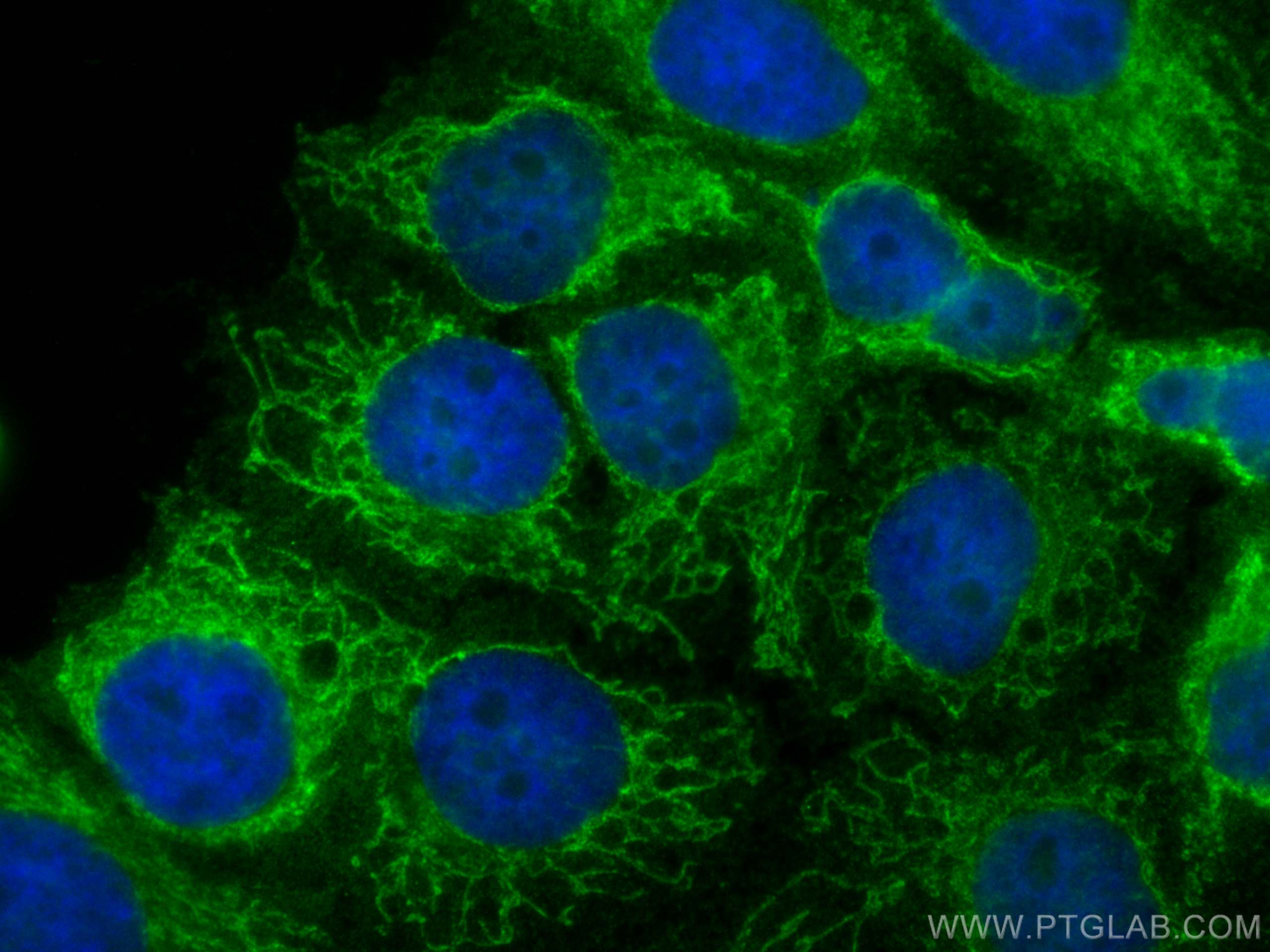 Immunofluorescence (IF) / fluorescent staining of HepG2 cells using ATP8 Polyclonal antibody (26723-1-AP)