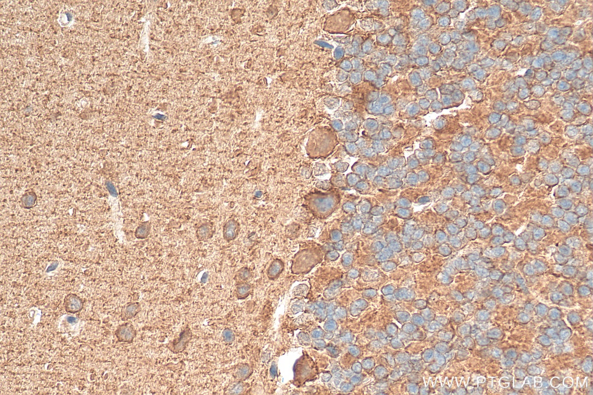 Immunohistochemistry (IHC) staining of mouse cerebellum tissue using ATP8 Polyclonal antibody (26723-1-AP)