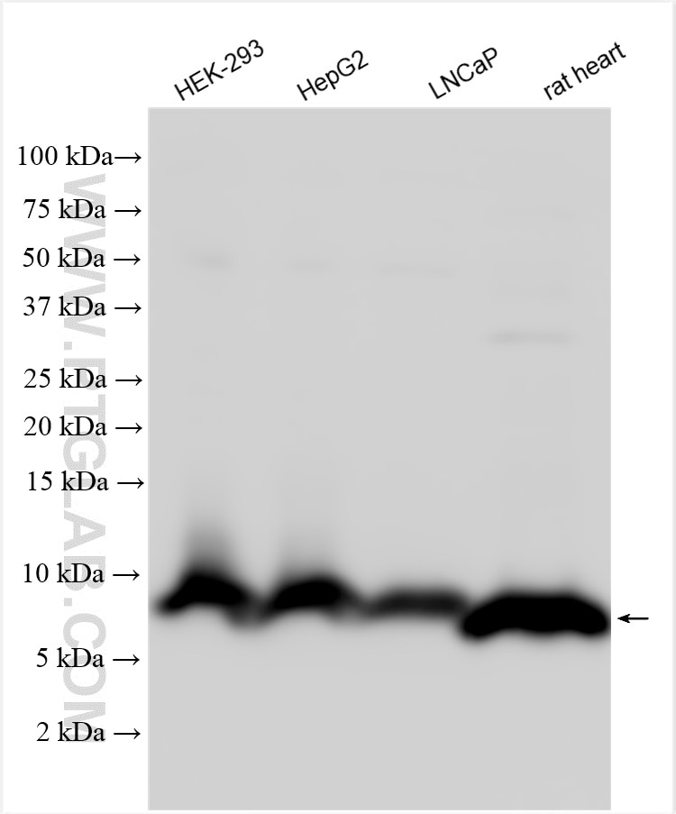 Western Blot (WB) analysis of various lysates using ATP8 Polyclonal antibody (26723-1-AP)