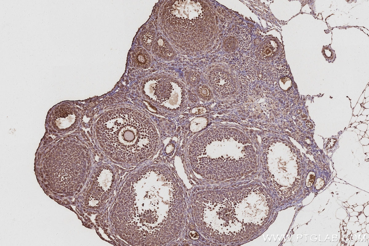 Immunohistochemistry (IHC) staining of mouse ovary tissue using ATP8A1 Polyclonal antibody (21565-1-AP)