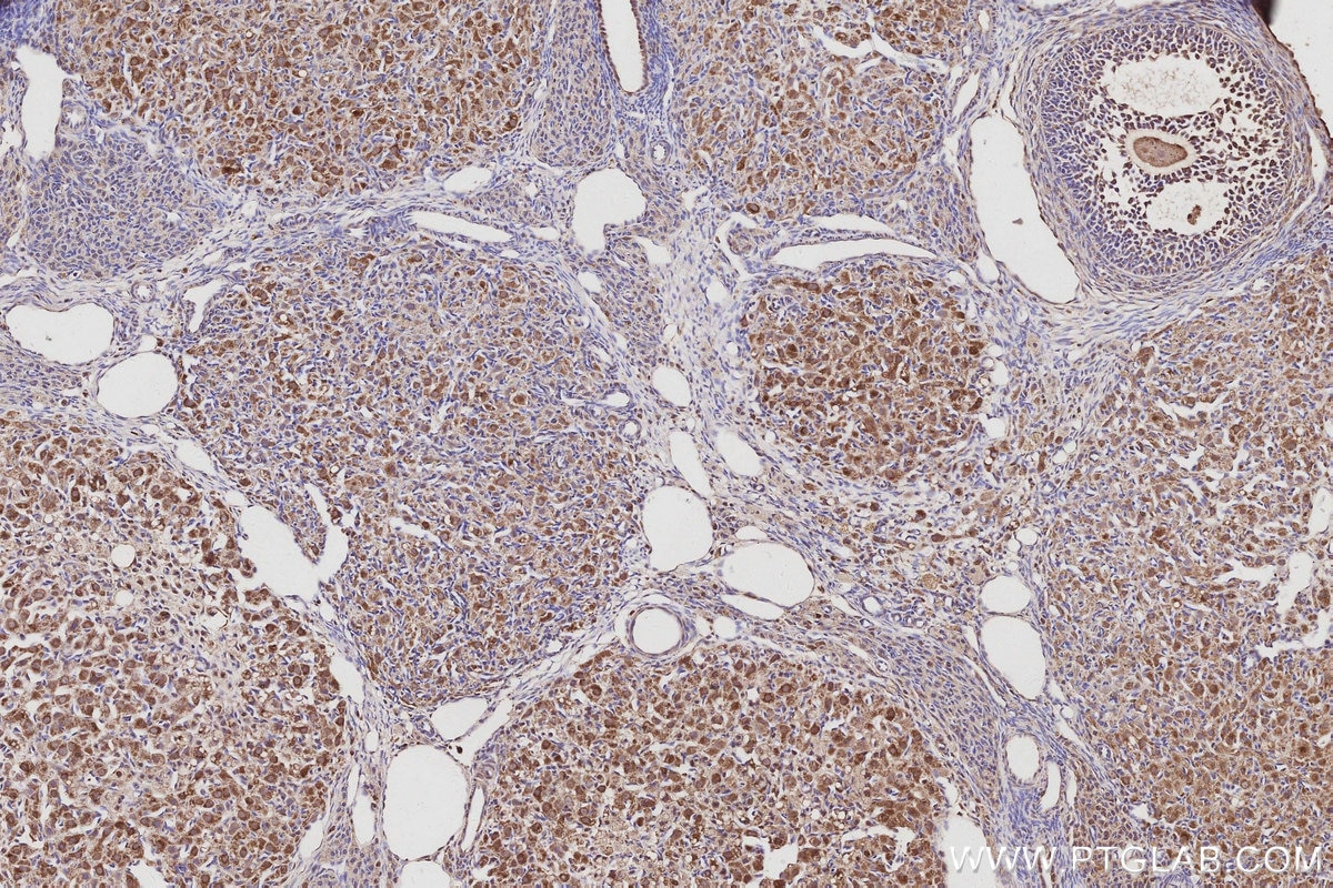 Immunohistochemistry (IHC) staining of rat ovary tissue using ATP8A1 Polyclonal antibody (21565-1-AP)