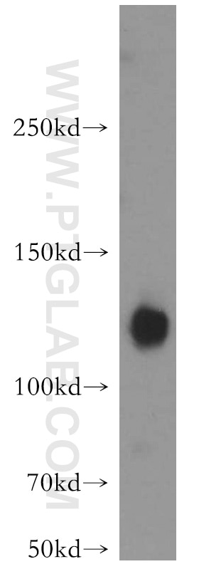 Western Blot (WB) analysis of mouse brain tissue using ATP8A1 Polyclonal antibody (21565-1-AP)
