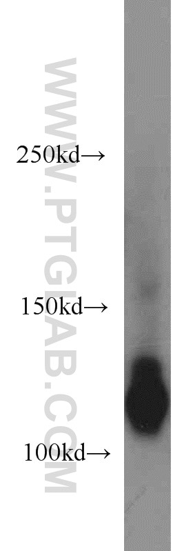 Western Blot (WB) analysis of mouse brain tissue using ATP8A1 Polyclonal antibody (21565-1-AP)