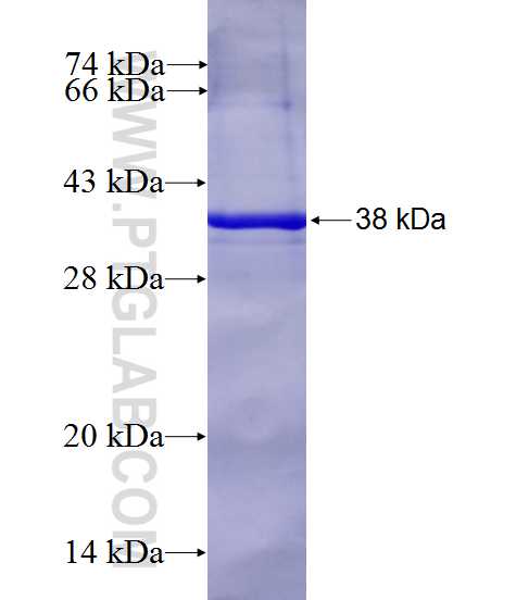 ATP8A1 fusion protein Ag28073 SDS-PAGE