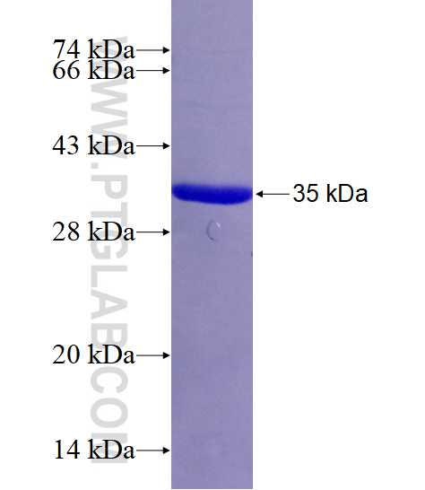 ATP8A1 fusion protein Ag16071 SDS-PAGE