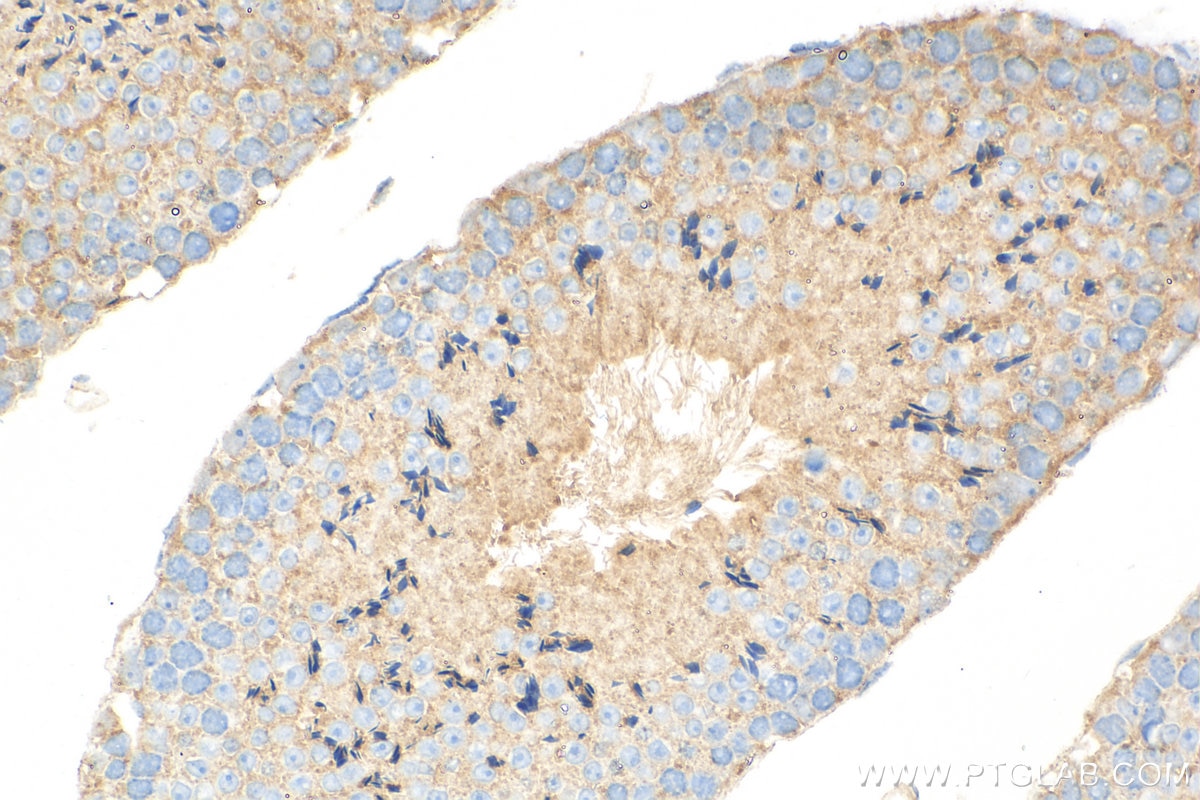 Immunohistochemistry (IHC) staining of mouse testis tissue using ATP8A2 Polyclonal antibody (31697-1-AP)