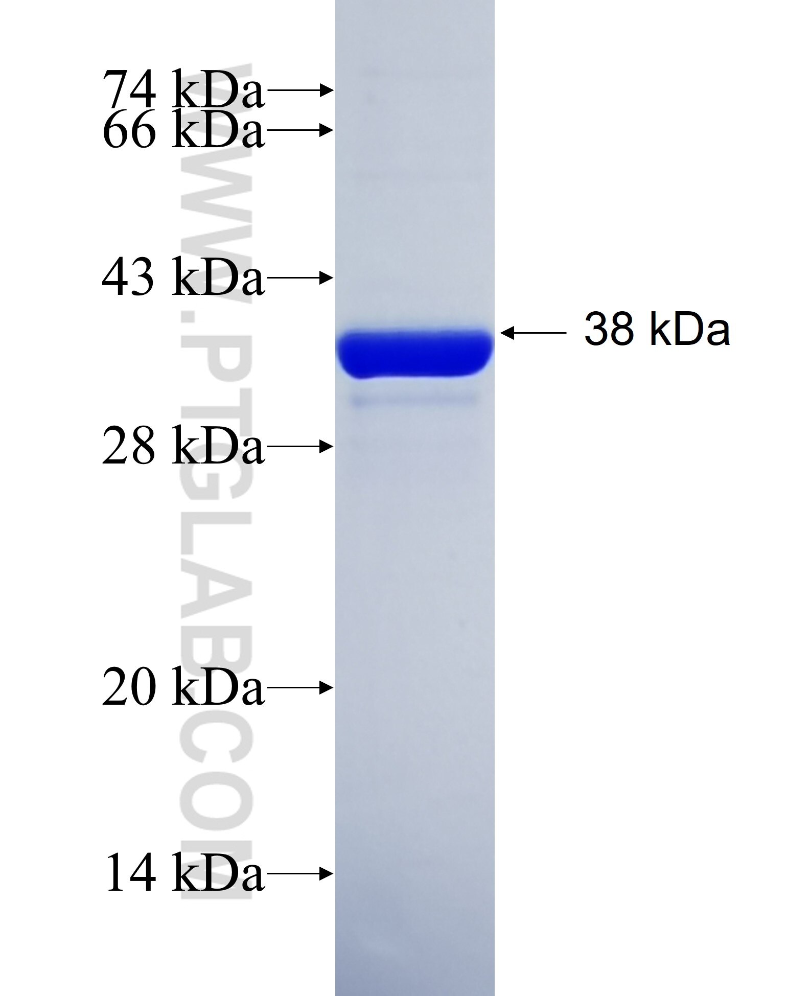 ATP8A2 fusion protein Ag36276 SDS-PAGE