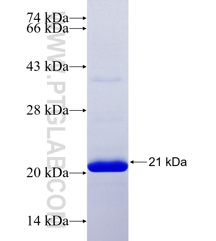 ATP8A2 fusion protein Ag36535 SDS-PAGE ATP8A2 fusion protein Ag36535 SDS-PAGE